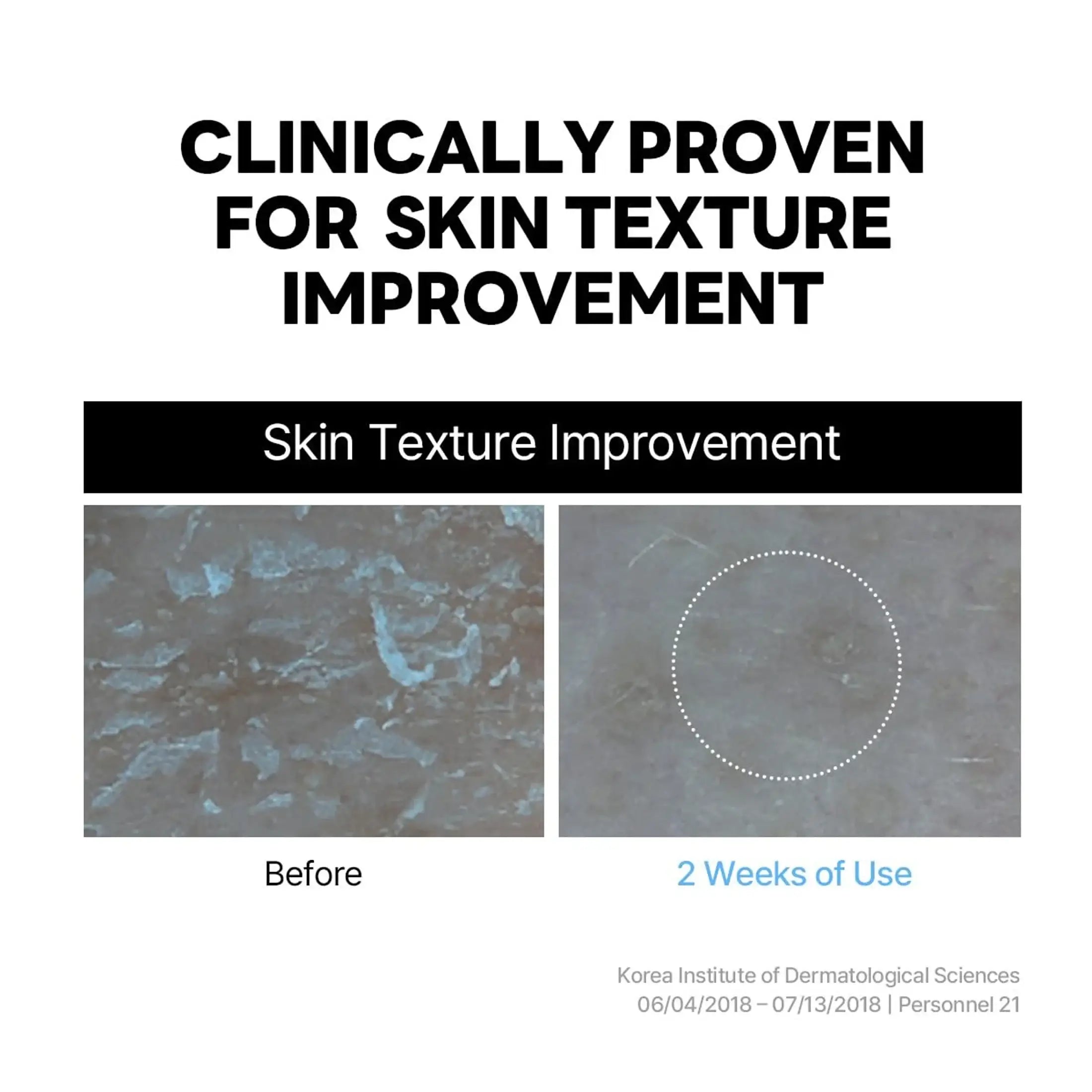 Round Lab 1025 Dokdo Cream skin texture improvement