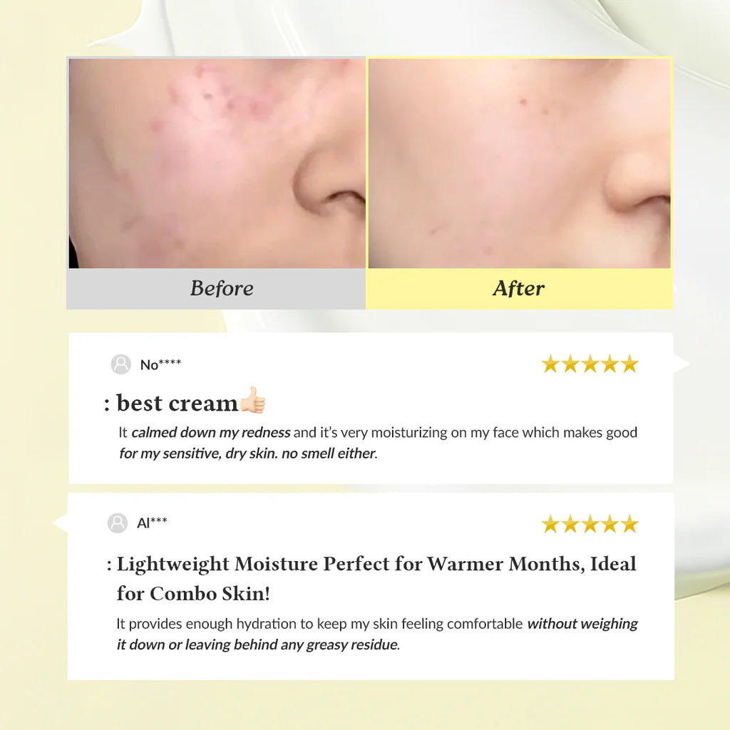 before and after Dr Althea 345 Relief Cream