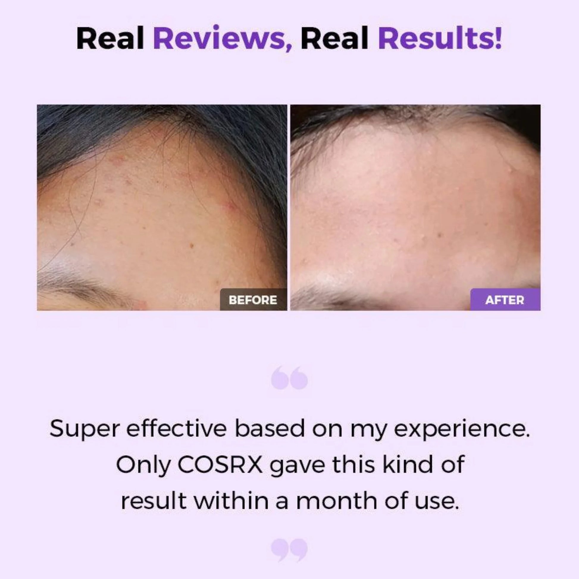 COSRX AHA/BHA Clarifying Treatment Toner results