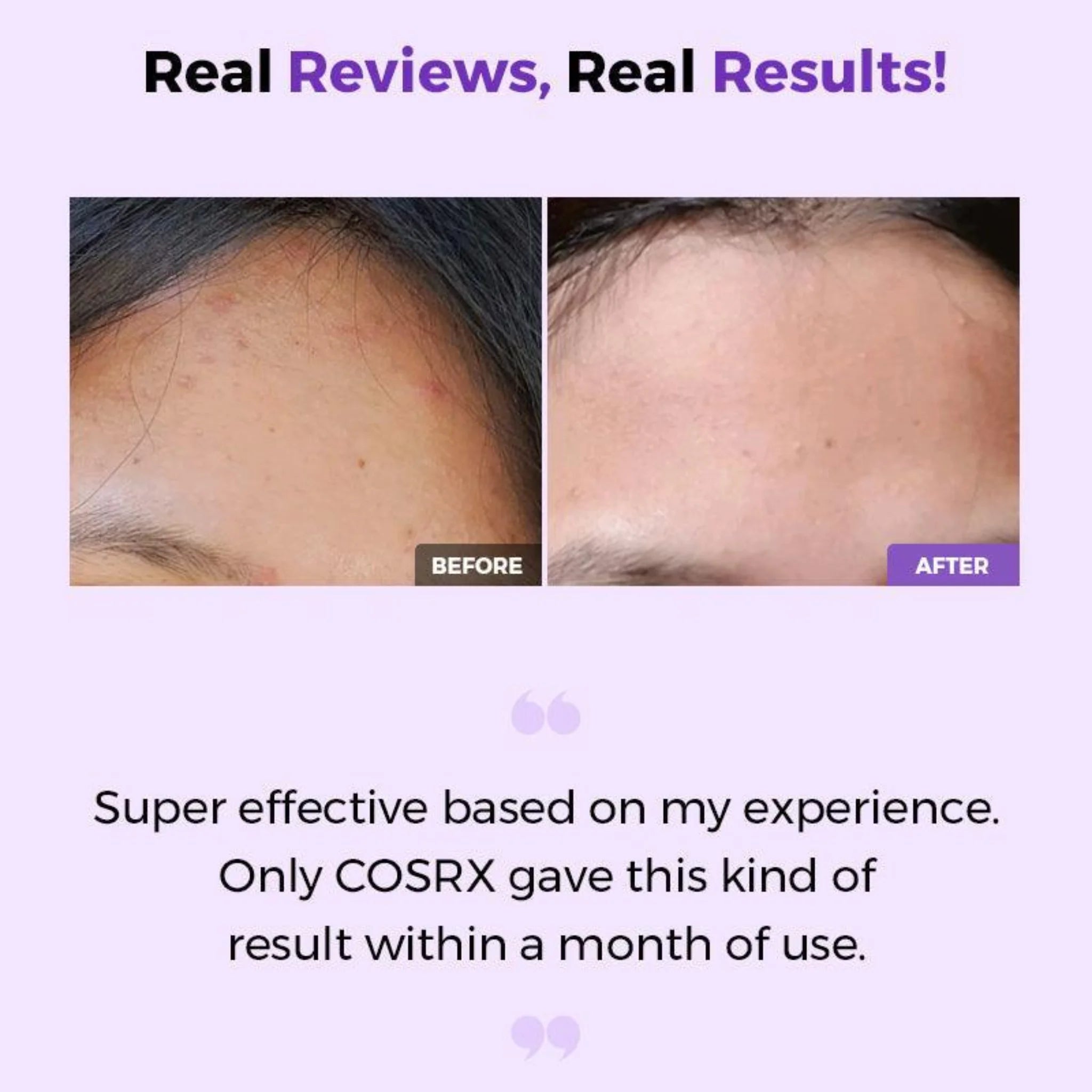 COSRX AHA/BHA Clarifying Treatment Toner results