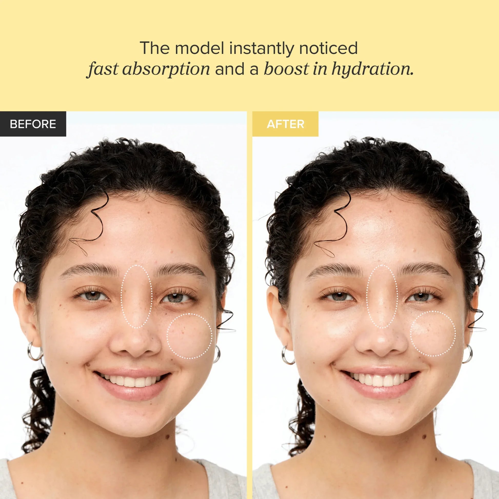 Glow Serum Propolis + Niacinamide before and after