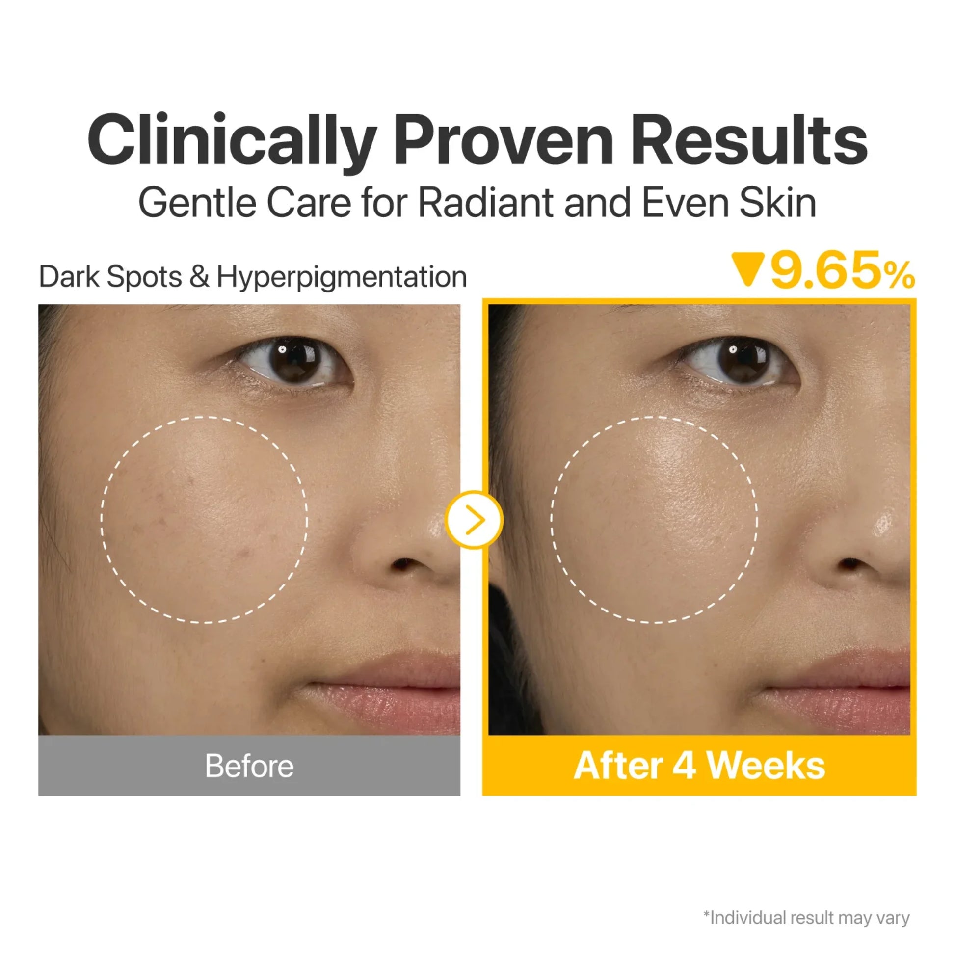 No.5 Vitamin Concentrated Serum before and after results