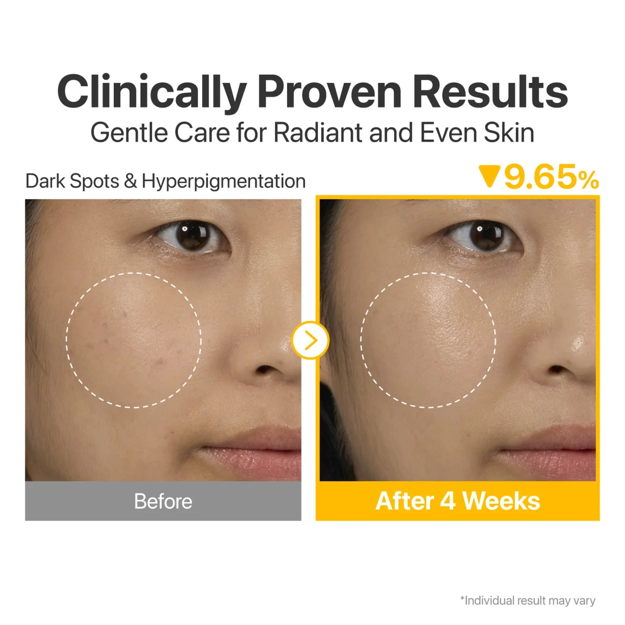 No.5 Vitamin Concentrated Serum before and after results