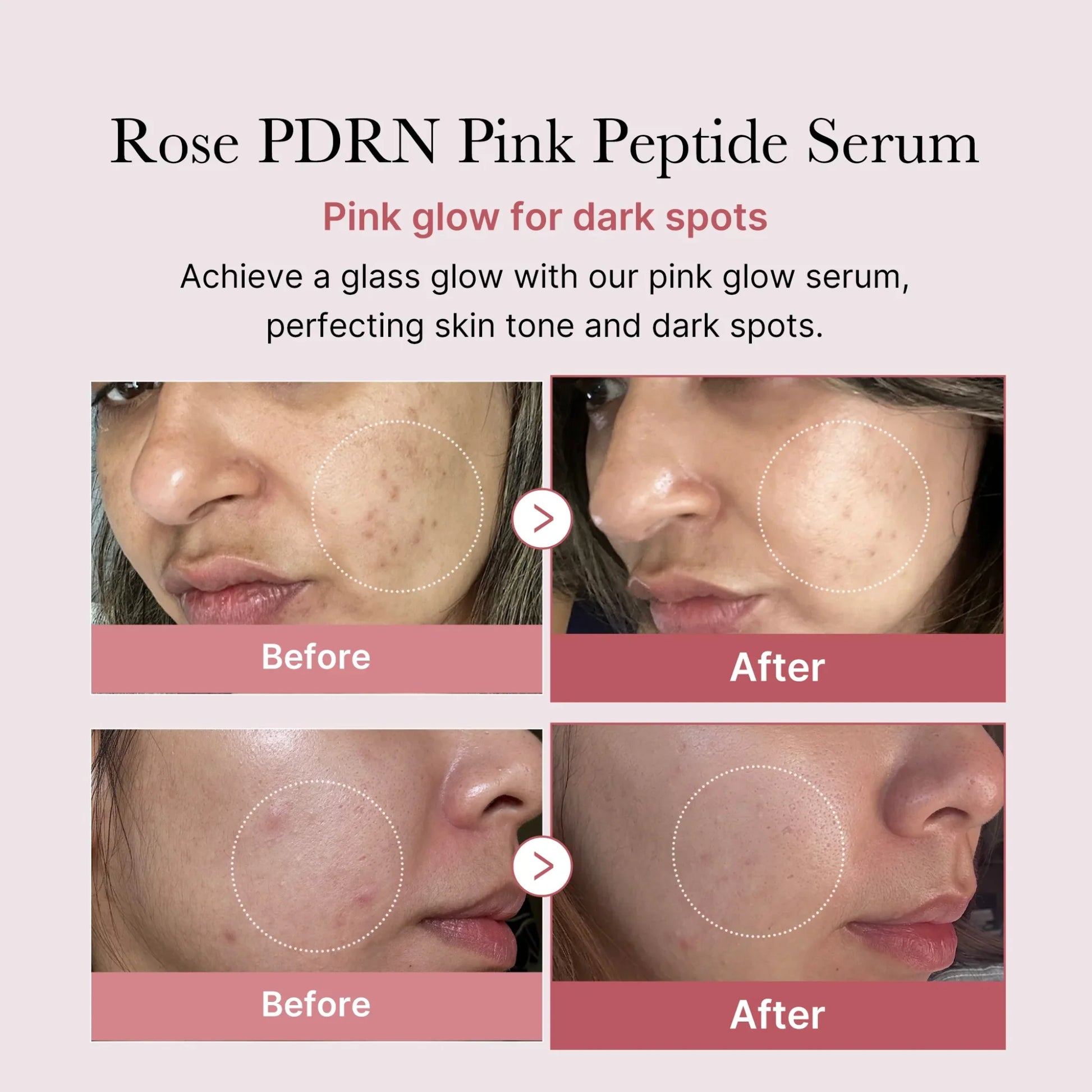 Medicube Rose PDRN Pink Peptide Serum results